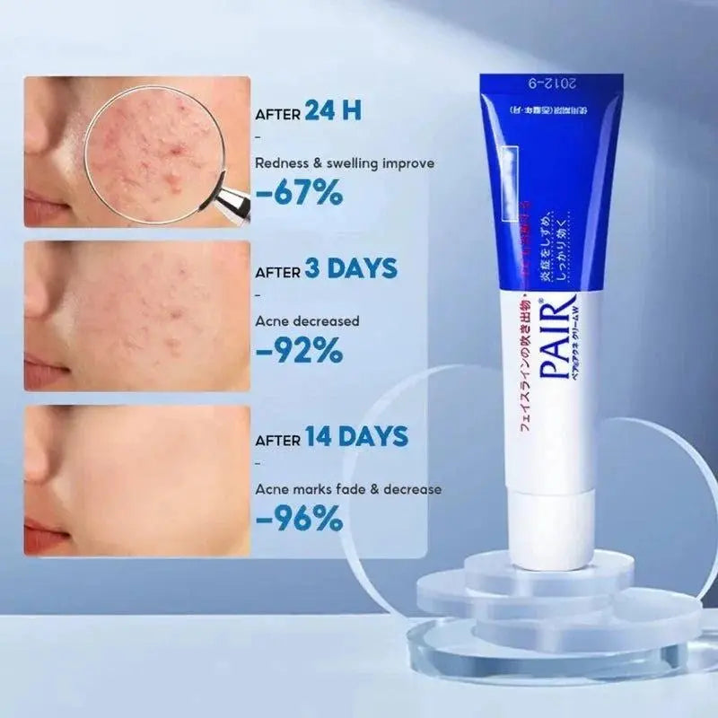 Lion Pair Acne Cream – Japanese Formula for Pimples & Redness, Gentle Daily Cleansing 24g Face K
